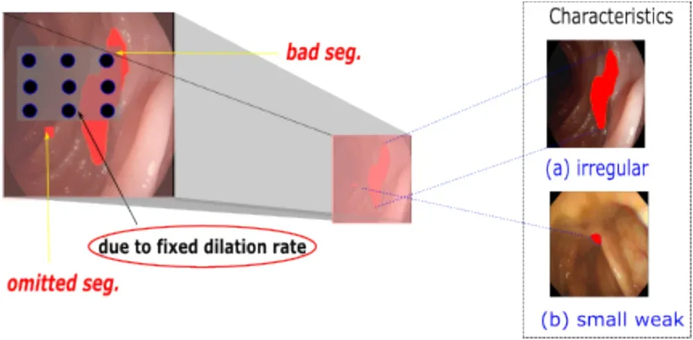 Figure 1 from “Flexible Dilated Convolution and Bidirectional Pyramid Approach to Polyp Segmentation”