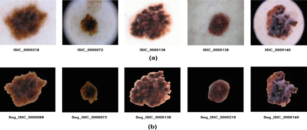 Figure 4 from “Leveraging DermoGrabcut Segmentation for Improved CNN-Based Skin Lesion Classification”